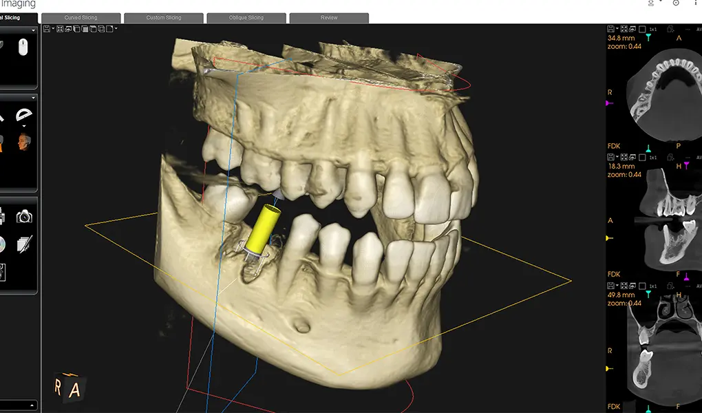 ノーベルガイドとは
