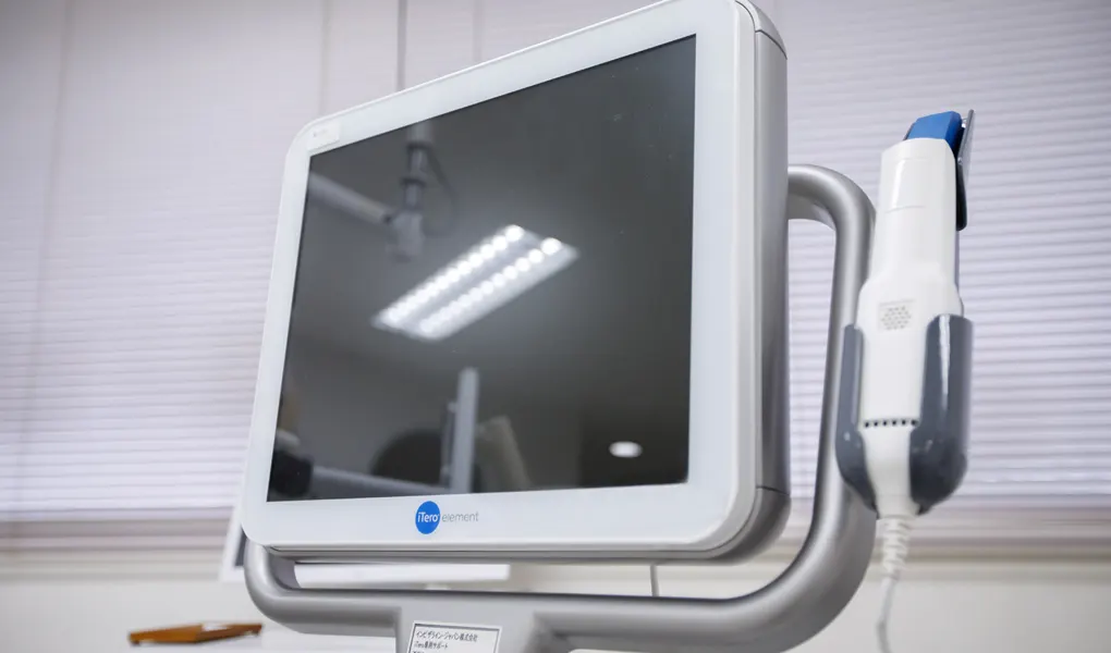 口腔内スキャナー(iTero)