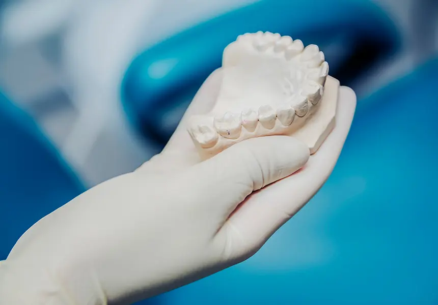 口内の型を採る