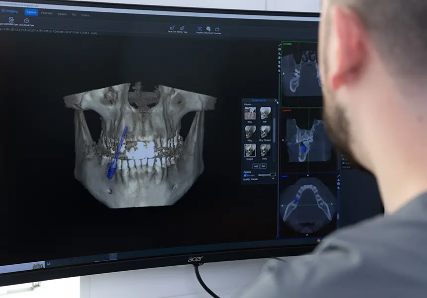 3D画像解析・手術のシミュレーション