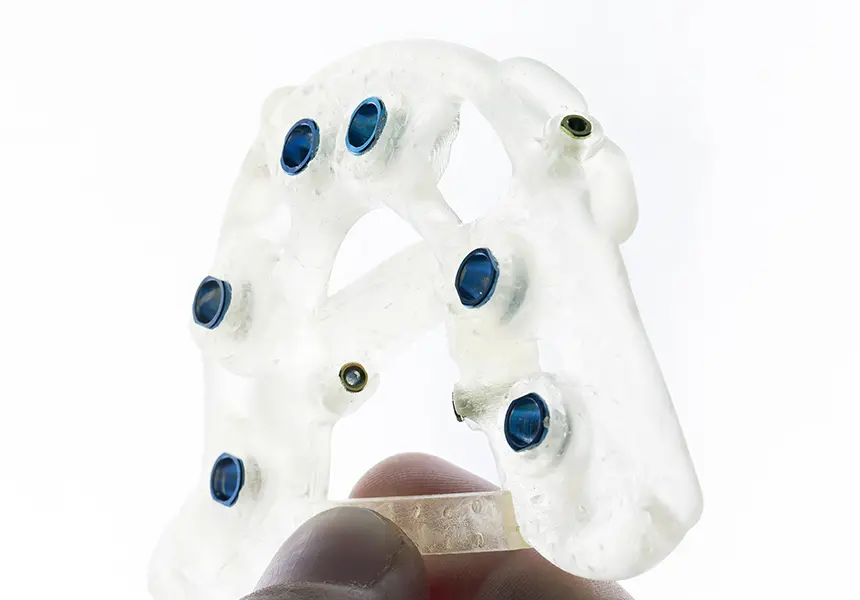 手術用テンプレート（サージカルガイド）作製