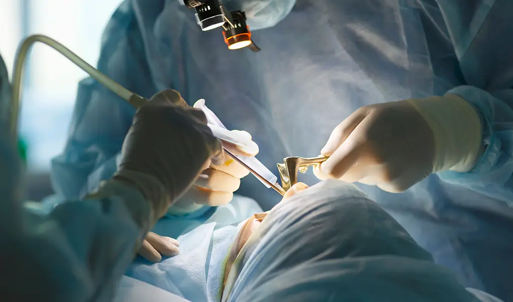 インプラントの素材