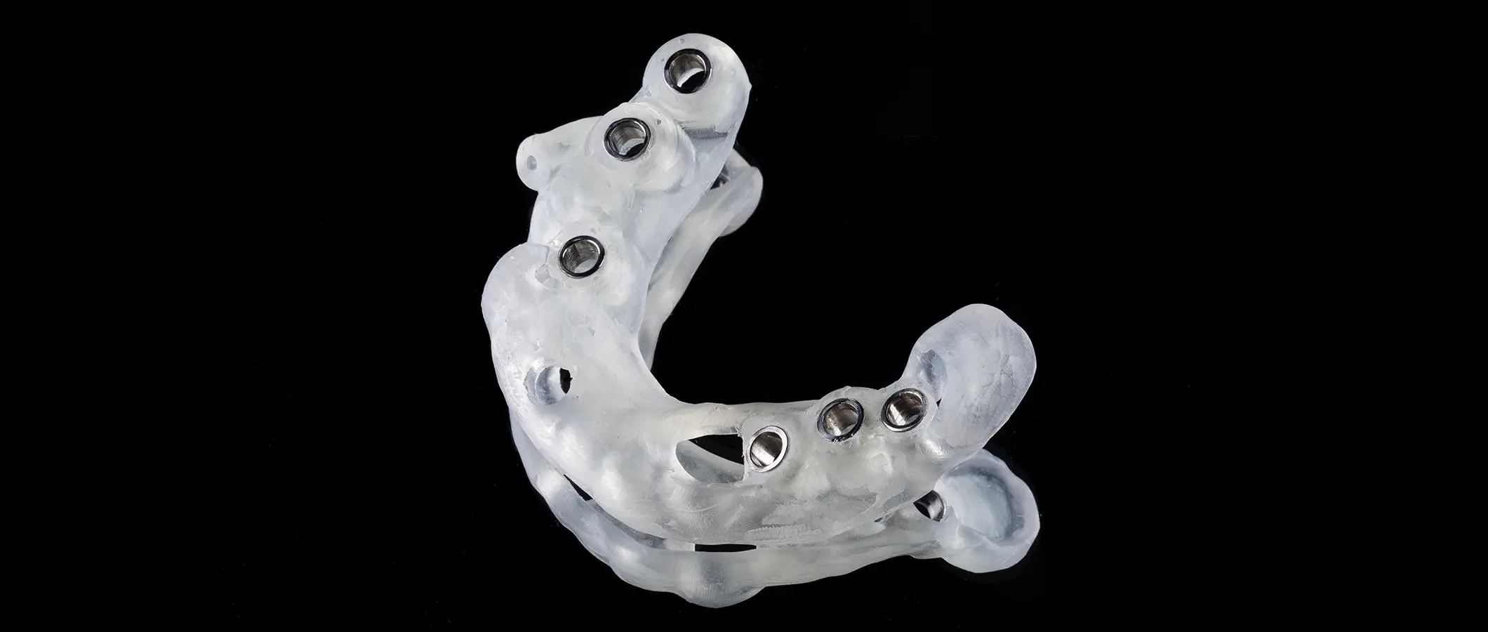 ガイデットサージェリー