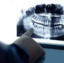 さまざまな治療