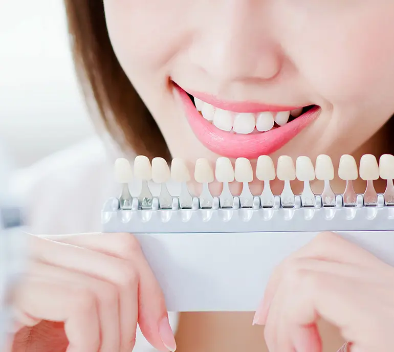 ホワイトニング