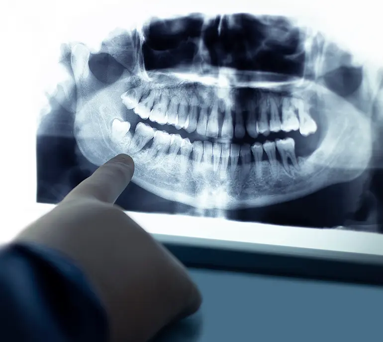 さまざまな治療